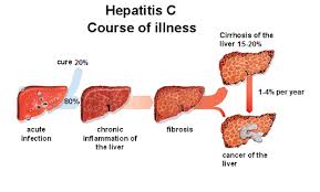 Obat Hepatitis